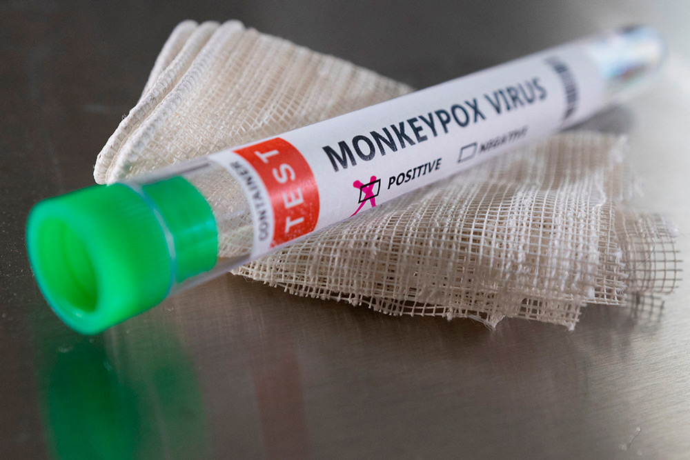Минздрав: вероятность завоза оспы обезьян в Беларусь оценивается как низкая