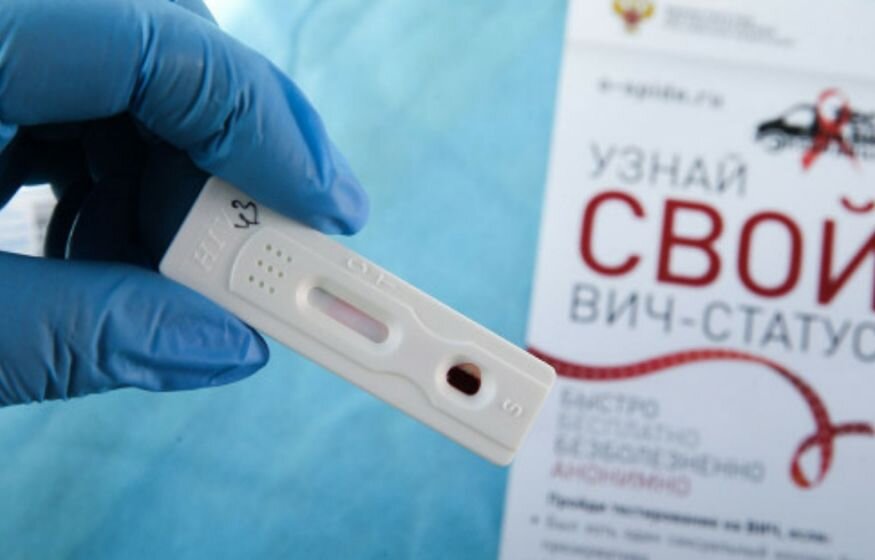 В Беларуси за январь-сентябрь зарегистрировано более 1,1 тыс. случаев ВИЧ-инфекции