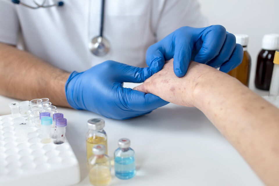 Врач рассказала, как достичь стойкой ремиссии псориаза