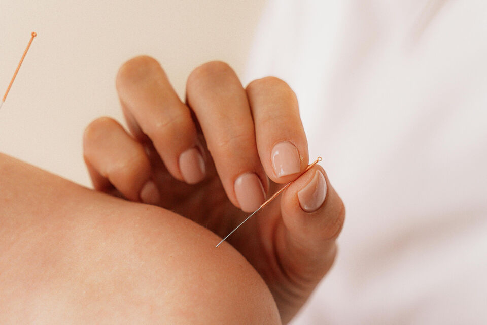 Иглоукалывание в домашних условиях закончилось серьезными повреждениями легких для жительницы Мозыря