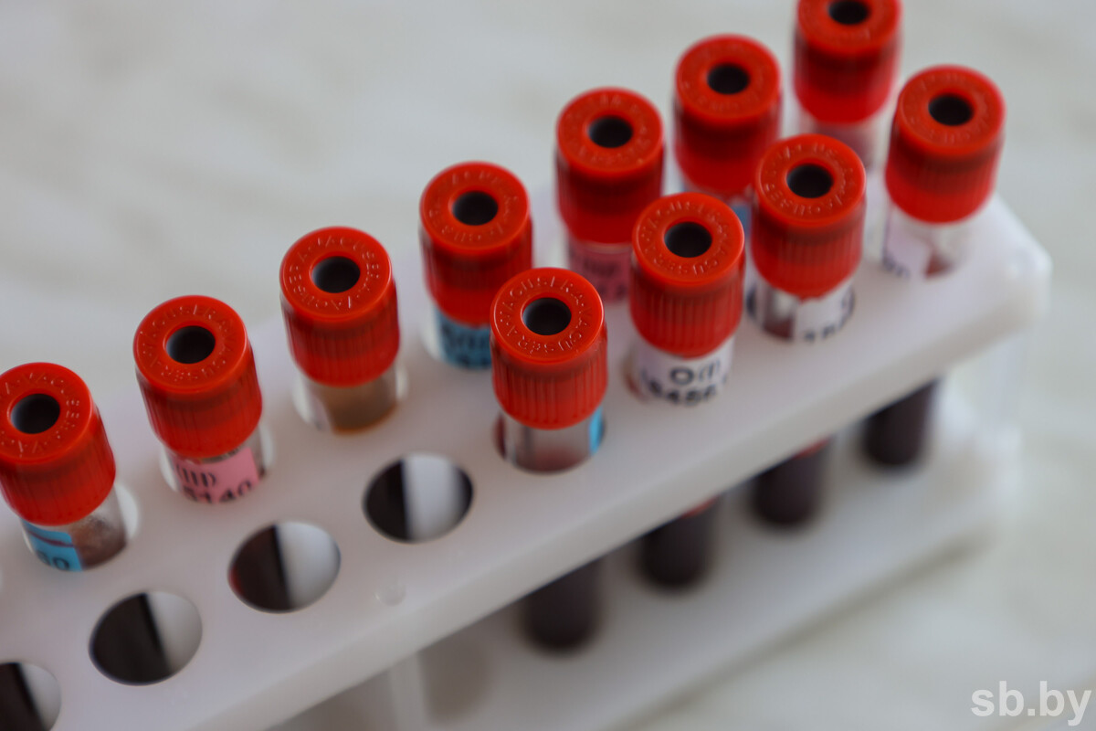 Терапевт перечислила 5 видов анализов, которые расскажут все о состоянии здоровья